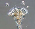 Stentor Protozoan