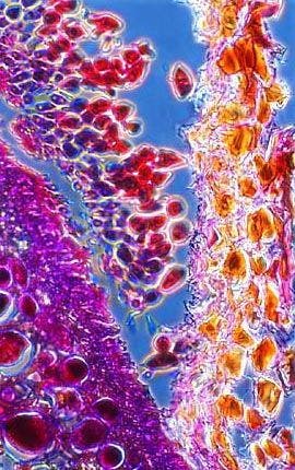 Rust Microspce Cedar Apple Rust Phase Contrast Microscopy Image | Gallery