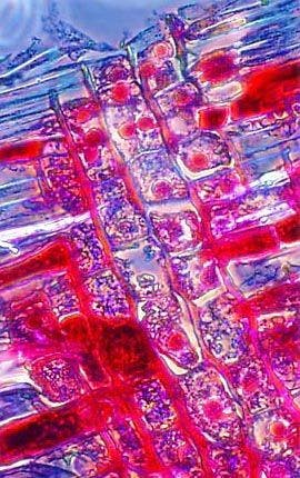 Wheat Rust Spermogonia | Phase Contrast Microscopy