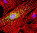 Fibroblasts