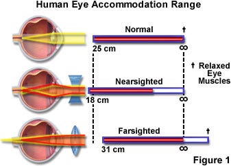 Human Eye Accommodation