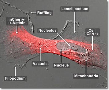 Human Glioblastoma Epithelial Cells with mCherry Actinin