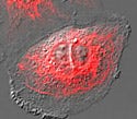 Rabbit Kidney Epithelial Cells with mKusabira Orange Keratin