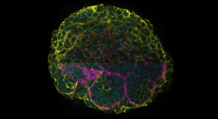 Human iPSC-derived kidney organoids shown as a raw image (top) and TruAI image (bottom).