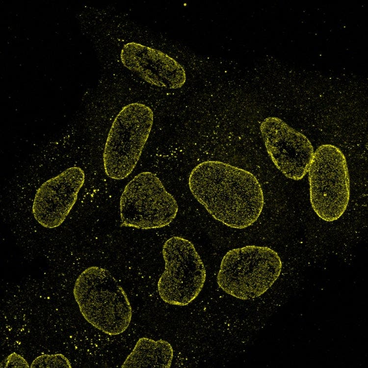 nuclear pore (AF561; yellow)