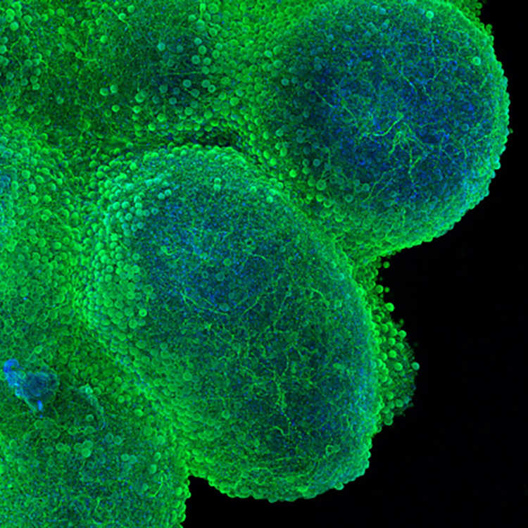 MAP2 (green) and Hoechst (blue) in a cortical organoid at DIV 45 with cell line KOLF2.1J.