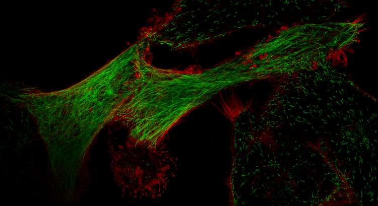 Cultured HeLa cells acquired in super-resolution mode on the FV5000 confocal laser scanning microscope.