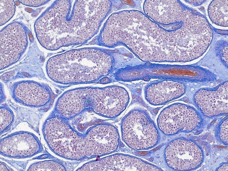 Specimen: Human (adult) testis; Microscope: CX23, Objective: Plan Achromat 10x (NA 0.25), TV-Adaptor: U-TV0.5XC-3, Illumination: Brightfield (LED), Exposure time: 2 ms