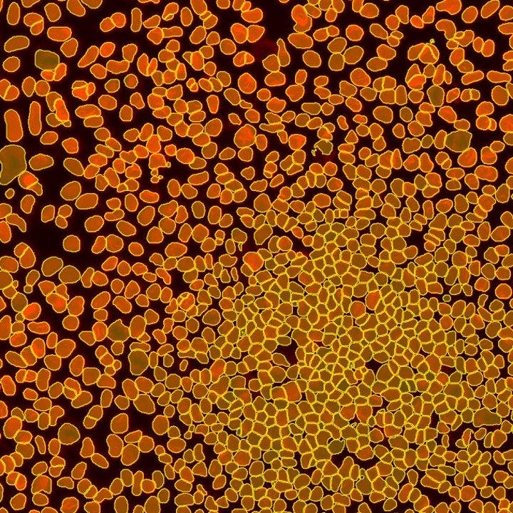 TruAI instance segmentation (right)