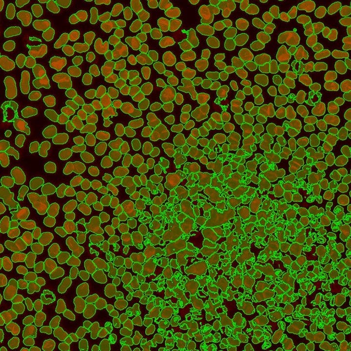 standard threshold segmentation (middle)