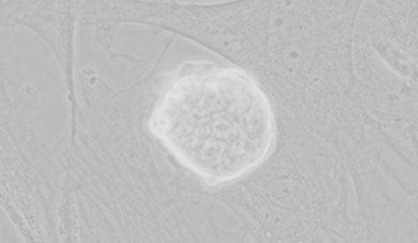 Phase contrast observation