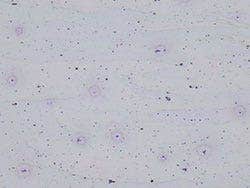 Aluminum alloy - Brightfield