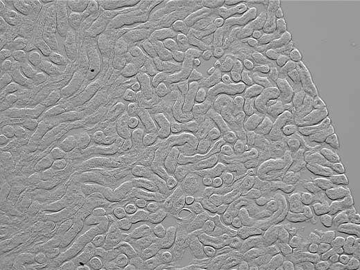 Mouse Kidney acquired by Gradient Contrast