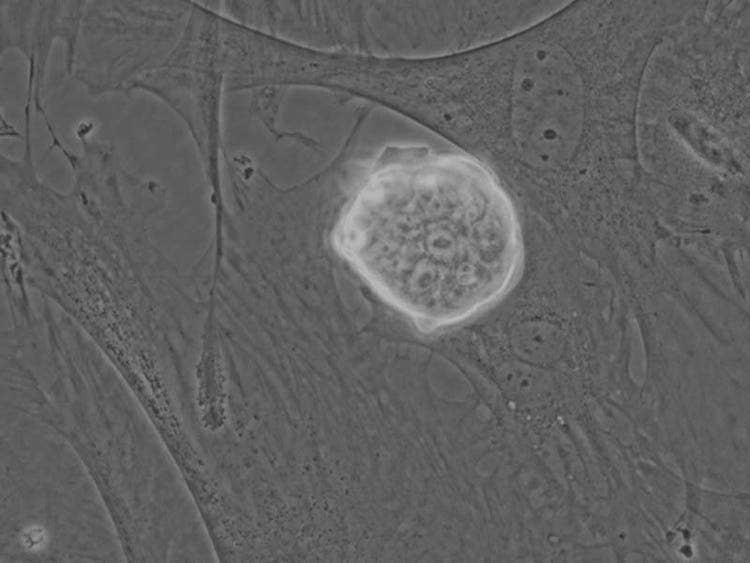 Phase contrast observation