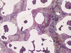 Spheroidal graphite cast iron - Brightfield