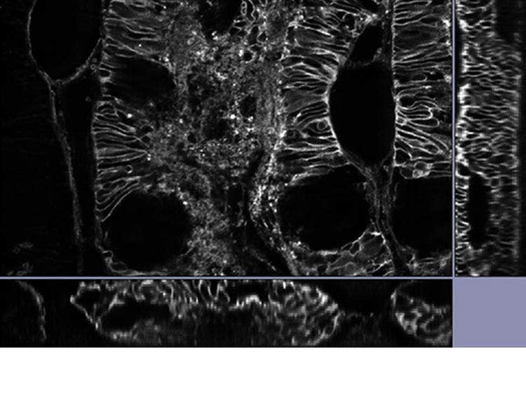 Super Resolution with TruSight