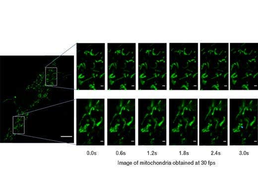 Mitochondria labeled by GFP. Acquired with 30 fps, able to see the individual mitochondria movements.