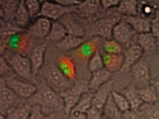 Luciferase, GFP and brightfield