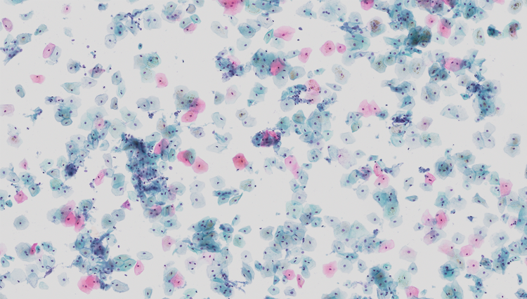 Images from left to right: multi-layer cytology (ThinPrep Pap test), single-plane histology (stomach, H&E)