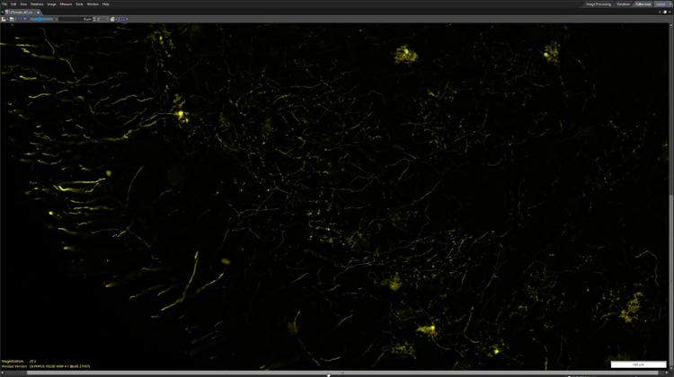 Optimized for Thick Samples