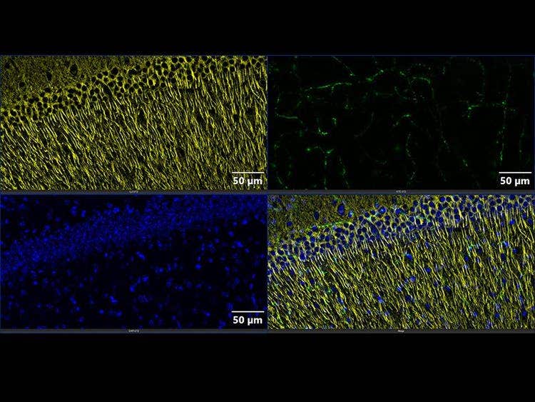 Optical Sectioning Technology