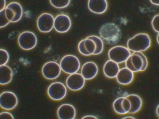 Erythrocytes and leukocytes