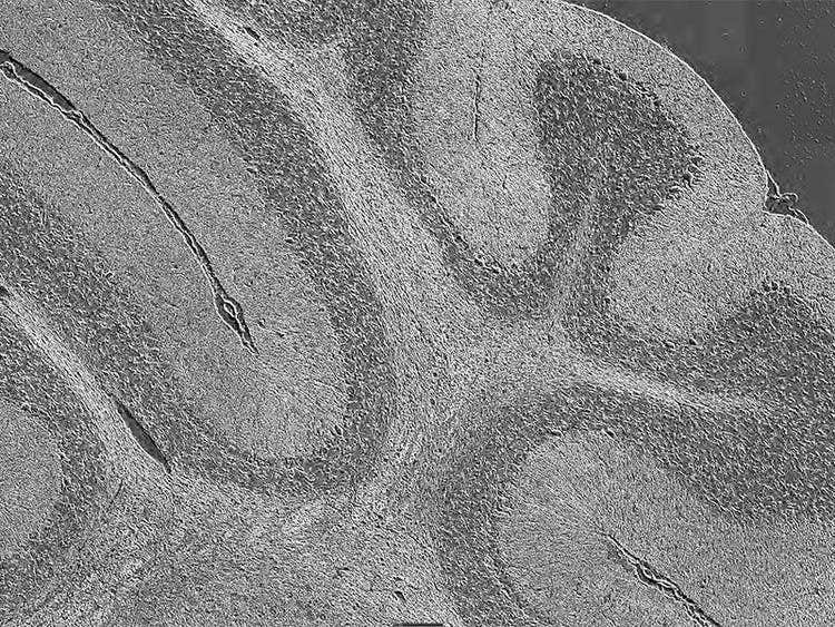 Sagittal section of a mouse brain