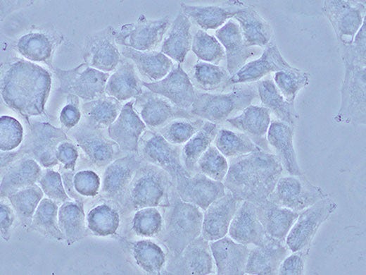 HeLa cells