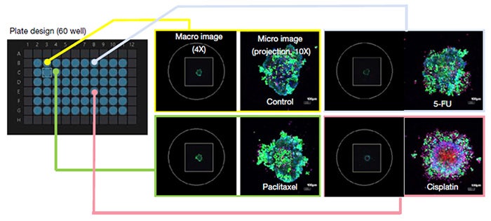 Figura 2. Adaptación del módulo de procesamiento de imágenes automatizado de nivel macro a micro para una prueba de viabilidad de medicamentos anticancerosos