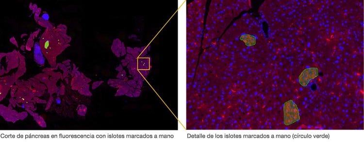 Corte de páncreas en fluorescencia con islotes marcados a mano / Detalle de los islotes marcados a mano (círculo verde)