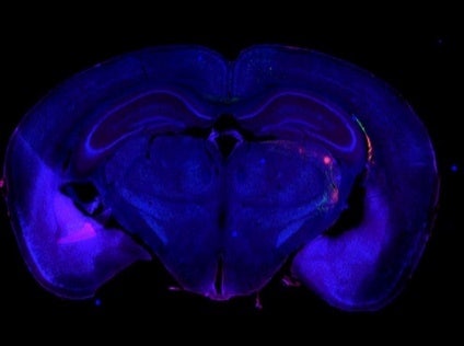 Investigación del cerebro