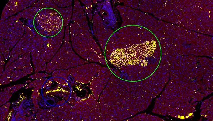 Imagen en 10x que muestra la detección por el método de umbral convencional en color amarillo, sin distinguir los islotes (círculo verde) de los glóbulos rojos (círculo azul).