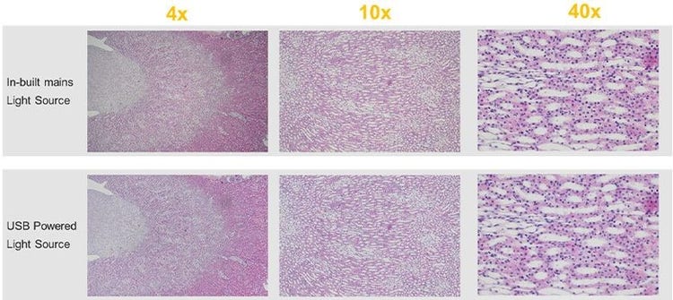 Mains powered light source versus USB battery-powered light source comparison of CX23 microscope images