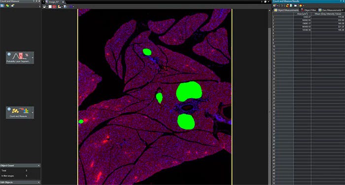 Los islotes pancreáticos detectados pueden ser segmentados y utilizados para análisis posteriores de recuento y medición en la imagen generada.