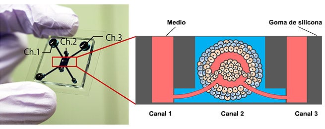 Figura 1. Dispositivo microfluídico y modelo de tumor.