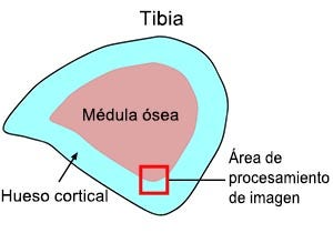 Figura 1: Seccionamiento transversal de la tibia