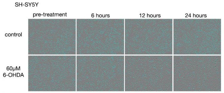 Figura 3. Imágenes de células SH-SY5Y tras los tratamientos con 6-OHDA.