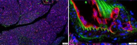 Microscopía de fluorescencia multiplexada