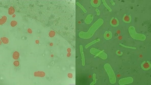 Utilizing Tumoroids to Explore Anti-Tumor Immunity in Rectal Cancer