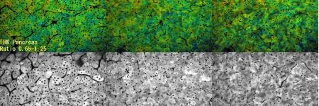 Páncreas de ratón bajo el microscopio