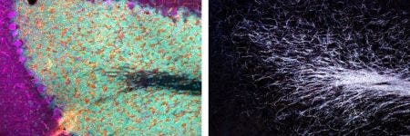 Procesamiento de imágenes confocales de reflectancia en complejos biomoleculares fibrilares