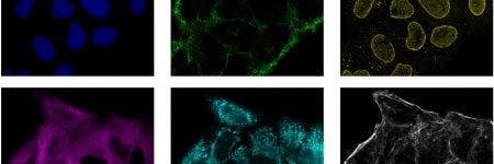 Imágenes de muestras adquiridas usando un microscopio confocal de Olympus