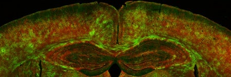 Investigación de la mielina para el Alzheimer