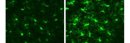 Procesamiento de imágenes profundas de un córtex visual de ratón vivo usando la microscopía multifotón