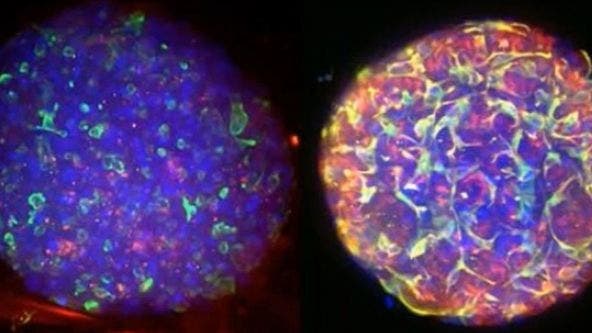 Converting from 2D to 3D: Bio-Techne Solutions for Your 3D Culture