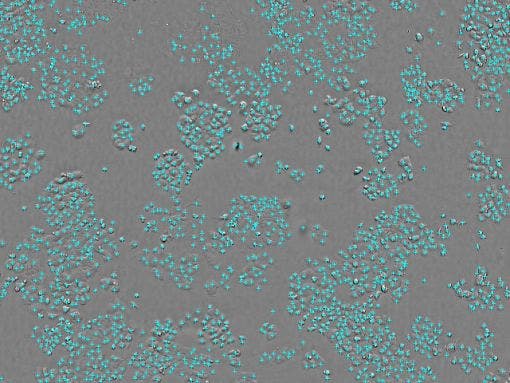 Cell count : 1.85 × 10³