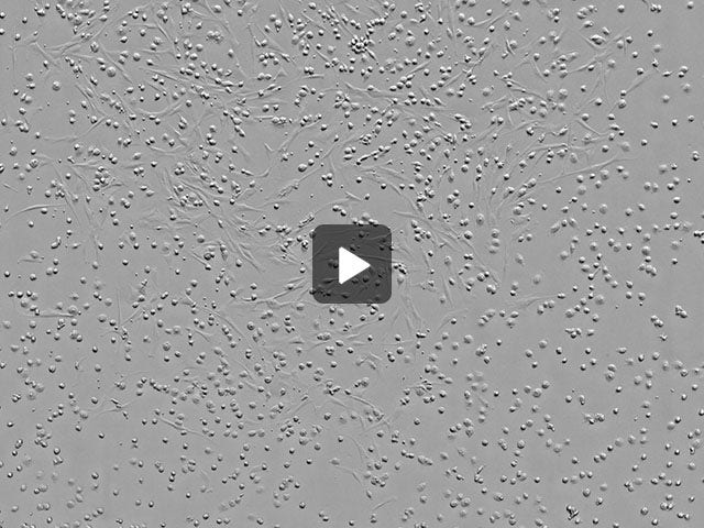 Primary culture of Bone Marrow Derived MSC