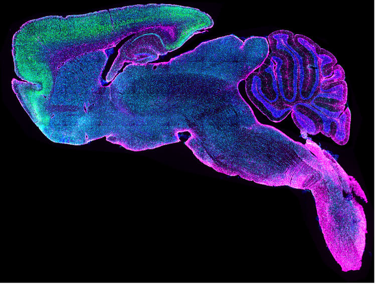 Imagen de portaobjetos completo de un corte sagital de cerebro de ratón teñido