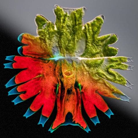 Alga verde Micrasterias