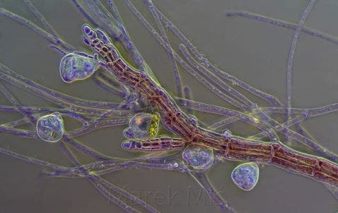 Vorticella fijada en algas rojas